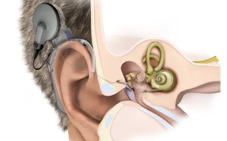 Audiological Devices Market Winning Strategies Leveraging Awareness, Affordability, and Digital Health Transformation