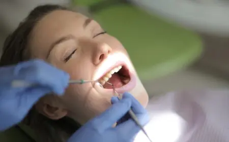 Replacing Old Dental Tooth Fillings When Is the Right Time