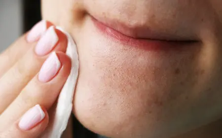 Which Acne Treatment Removes Blackheads Quickly?