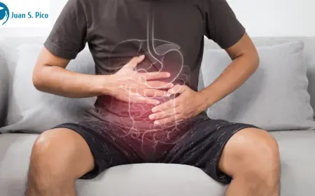 What Are My Options for Post-Colon Cancer Care in San Antonio, TX?