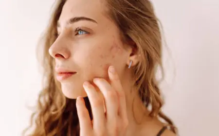 Best Dermatologist in Dubai for Hair Loss and Scalp Treatments