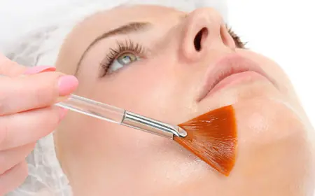 Choosing the Right Chemical Peel in Dubai: A Complete Guide