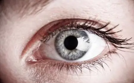 Eyelid Surgery Recovery Tips for Riyadh Patients