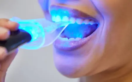 Is Zoom Teeth Whitening in Dubai Right for You?