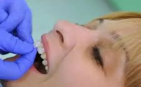 Dental Veneers in Islamabad – Get a Perfect Hollywood Smile