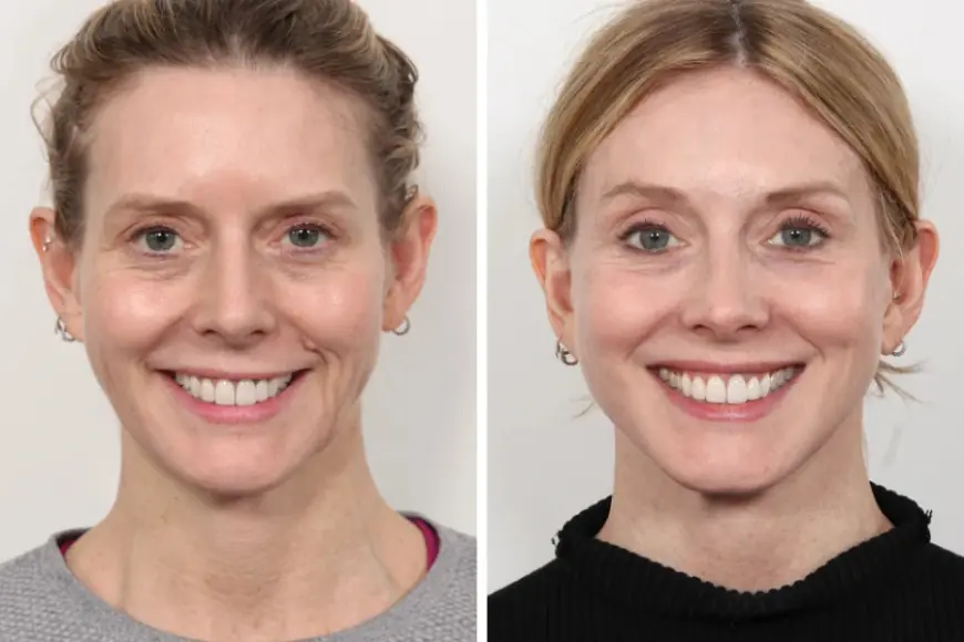 Transform Your Look at the Best Aesthetic Clinic in Dubai