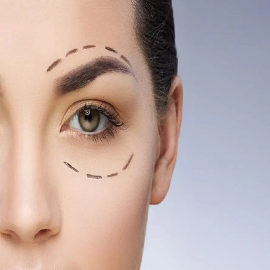 Affordable Eyelid Surgery in Islamabad Without Compromising Quality