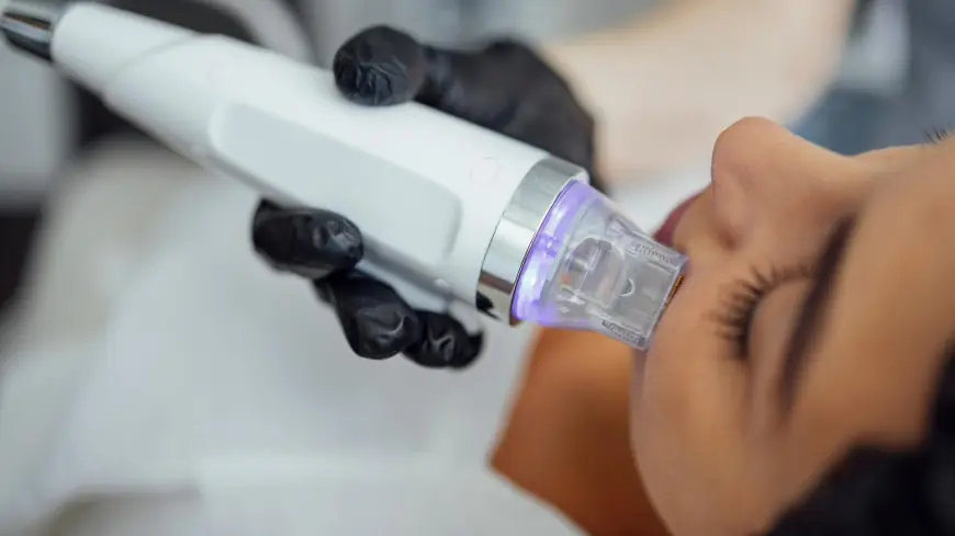 Fractional RF Microneedling Gets Skin Looking Timeless