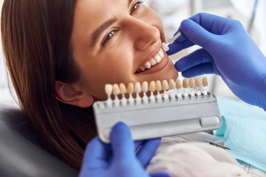 What’s the Recovery Time for Composite Veneers?