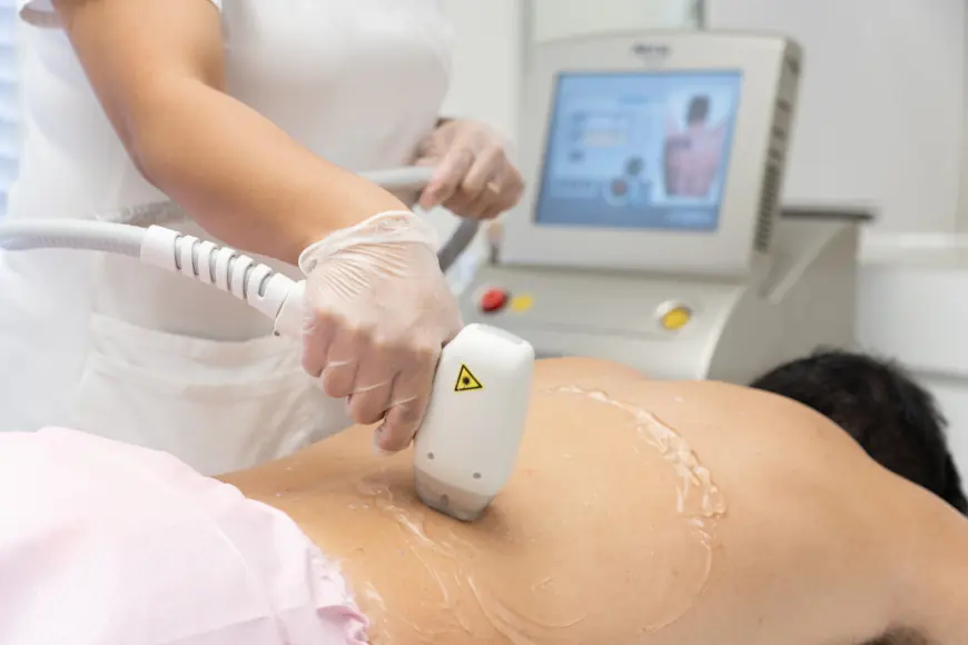 Laser Hair Removal in Dubai: A Safe Option for Teens?