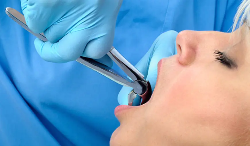 How Dentists Perform Tooth Removal: Step-by-Step Process