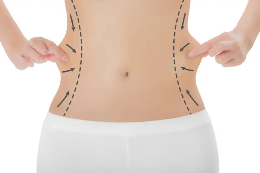 Transform Your Body: Riyadh Liposuction Insights