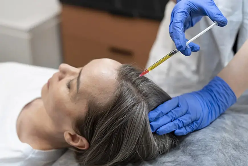 When Should You Try the Best PRP Hair Treatment?