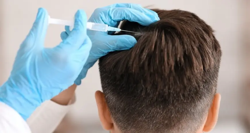 Best PRP Hair Treatment in Dubai