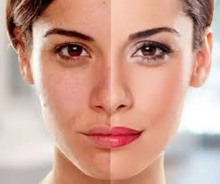 Discover Brighter Skin with Skin Whitening Treatments in Islamabad