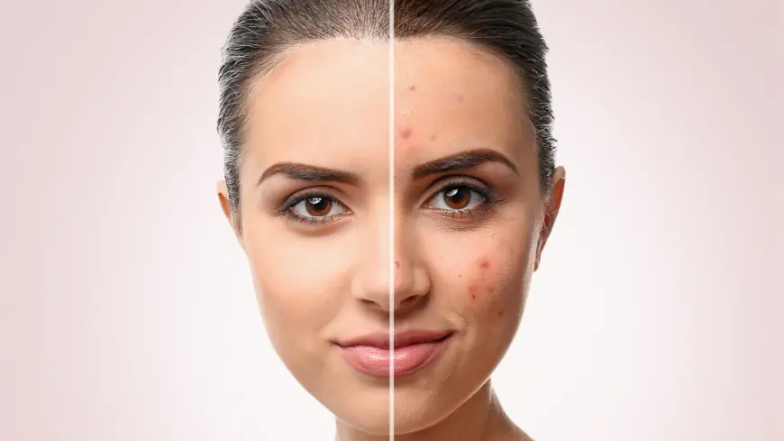 Step-by-Step: What to Expect During Your Scar Removal Procedure in Dubai