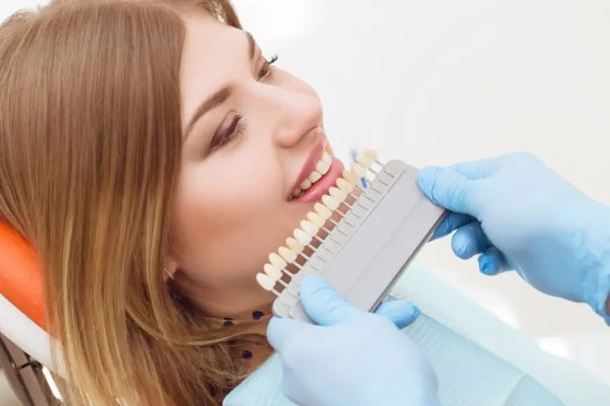 Watch Your Smile Transform with Composite Veneers