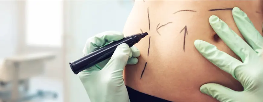Setting Up the Ideal Home Post-Liposuction in Dubai