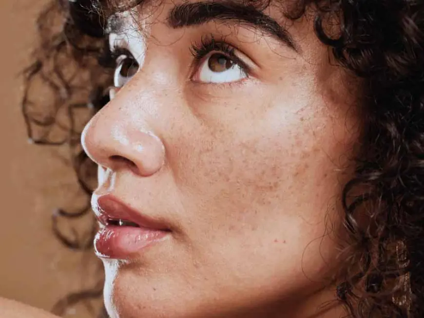 Can Dermal Pigmentation Be Removed Safely?
