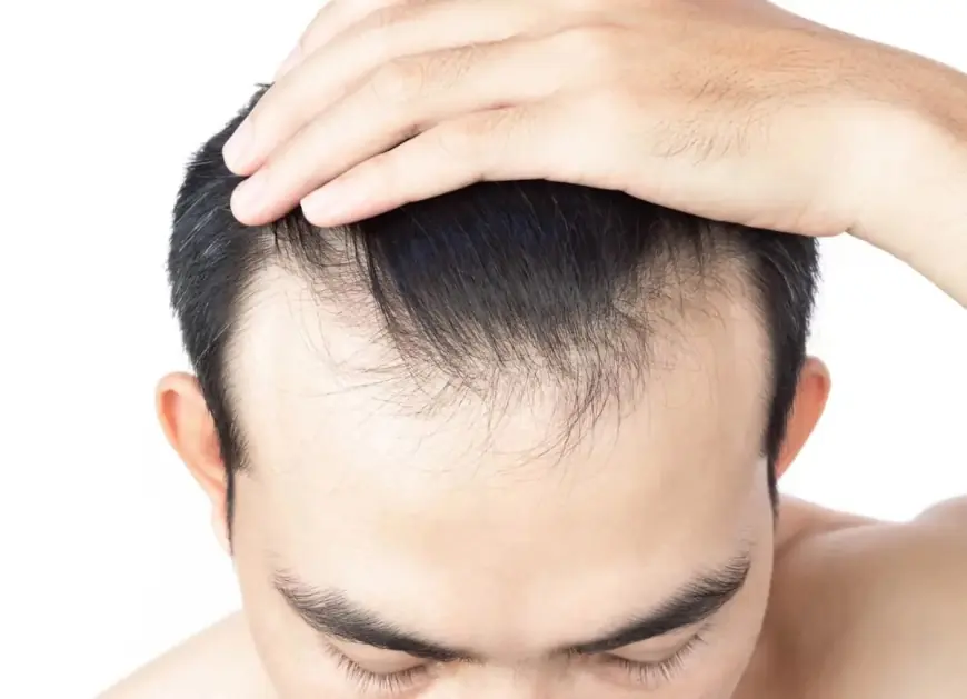 Front Line Hair Fixing Myths