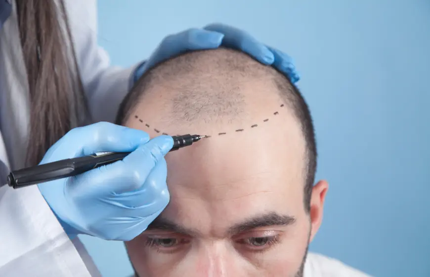 Front Line Hair Fixing