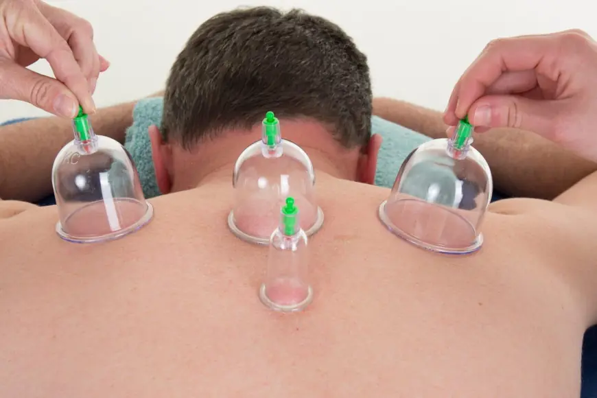 Insider Access to Best Hijama Treatment Cost in Dubai Offers