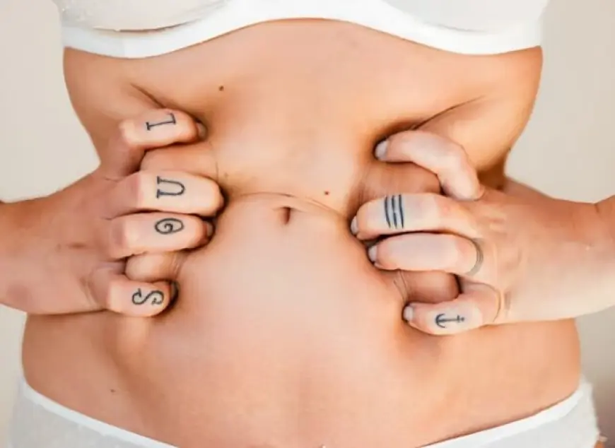 Top Benefits of Getting a Tummy Tuck in Islamabad