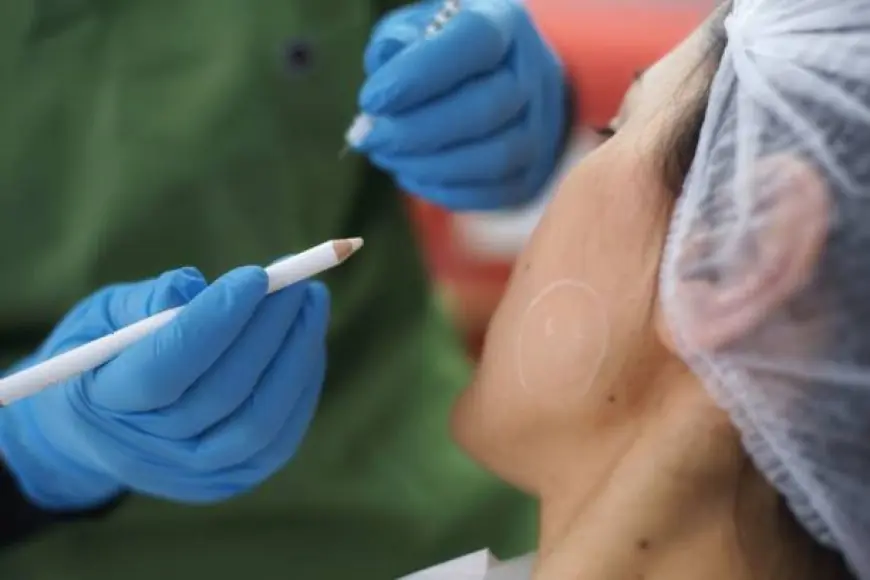 Revitalize Your Appearance with Botox Injection in Dubai