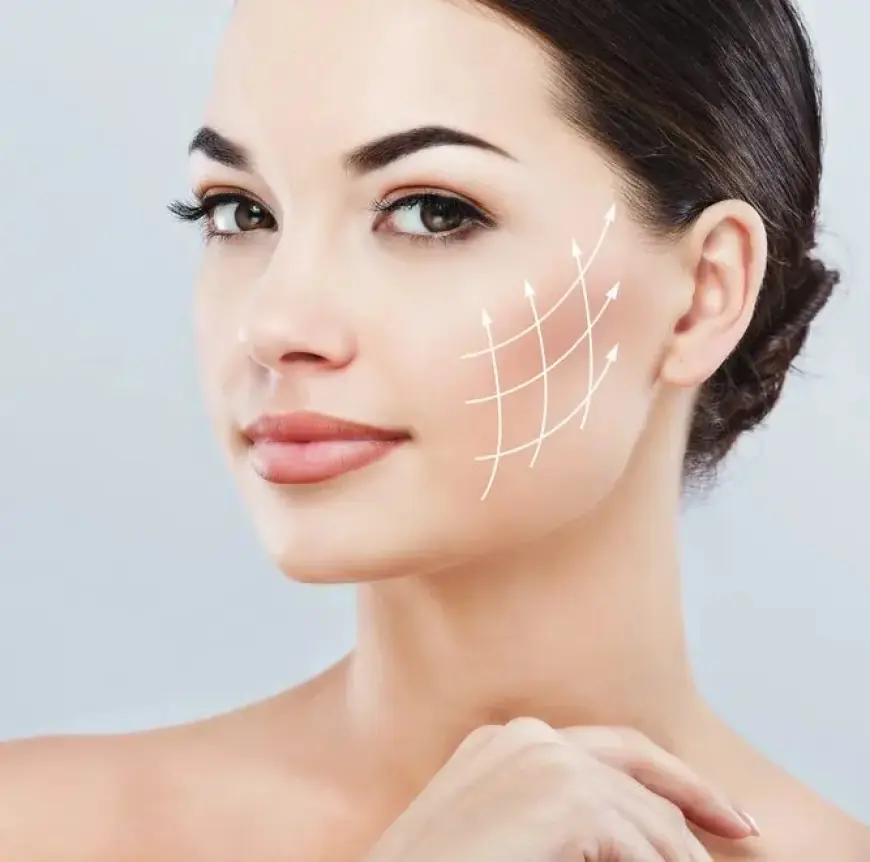 Are Sugar Thread Lifts Effective for Wrinkle Reduction?