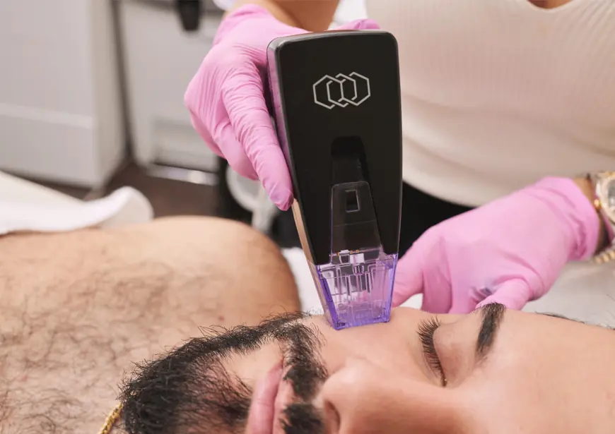 Morpheus8 Treatment Dubai Is the Ultimate Glow Solution