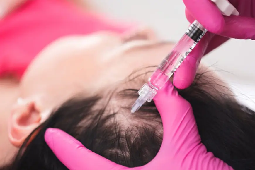 PRP Treatment for Hair in Islamabad: Everything You Should Know