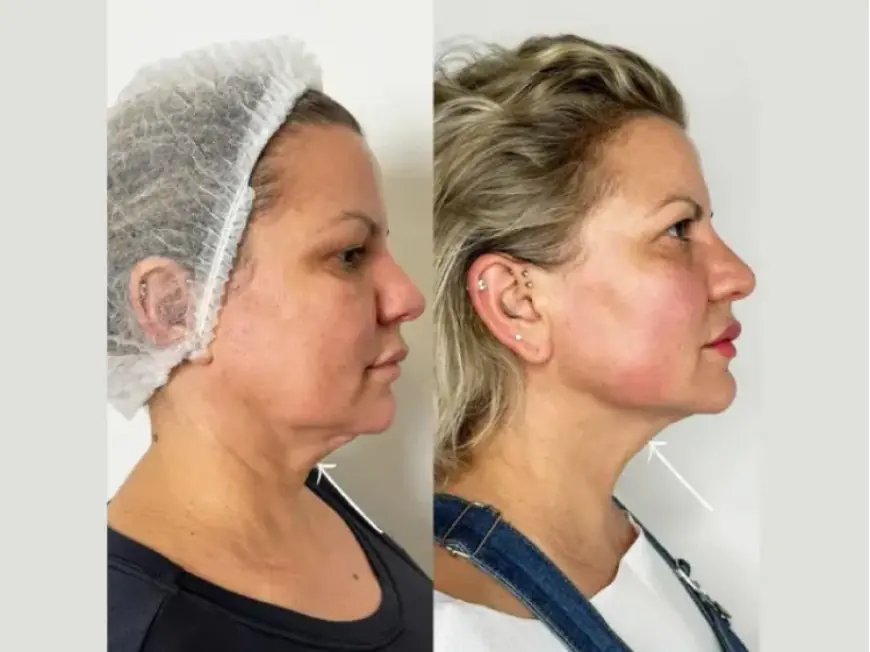Revolutionizing Beauty in the Best Aesthetic Clinics in Dubai