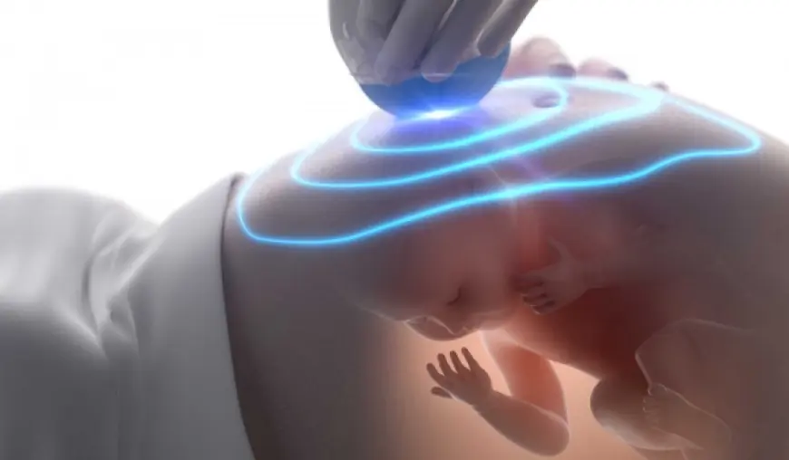 Understanding Ultrasound Machine Cost: A Complete Guide for Healthcare Providers