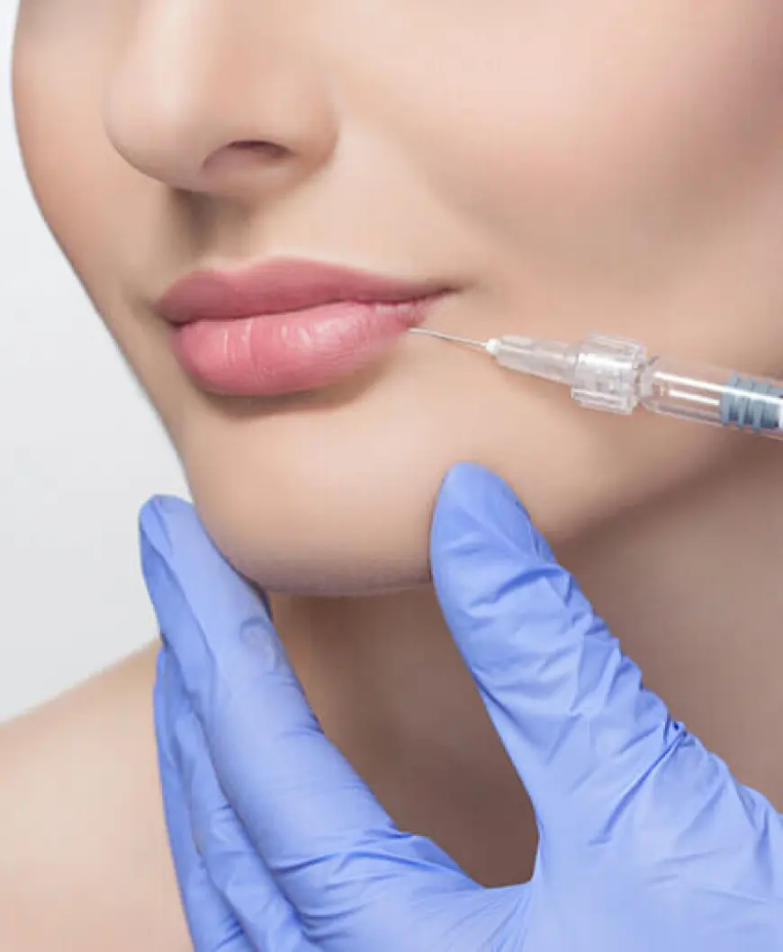 Can You Still Kiss After Russian Lip Fillers?