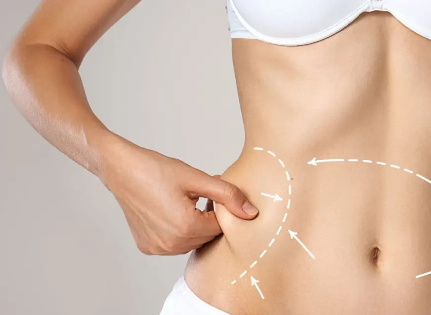 What Results Can You Really Expect from Liposuction?