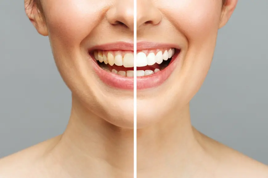 Transform Your Smile with a Leading Cosmetic Dentist in Cary NC