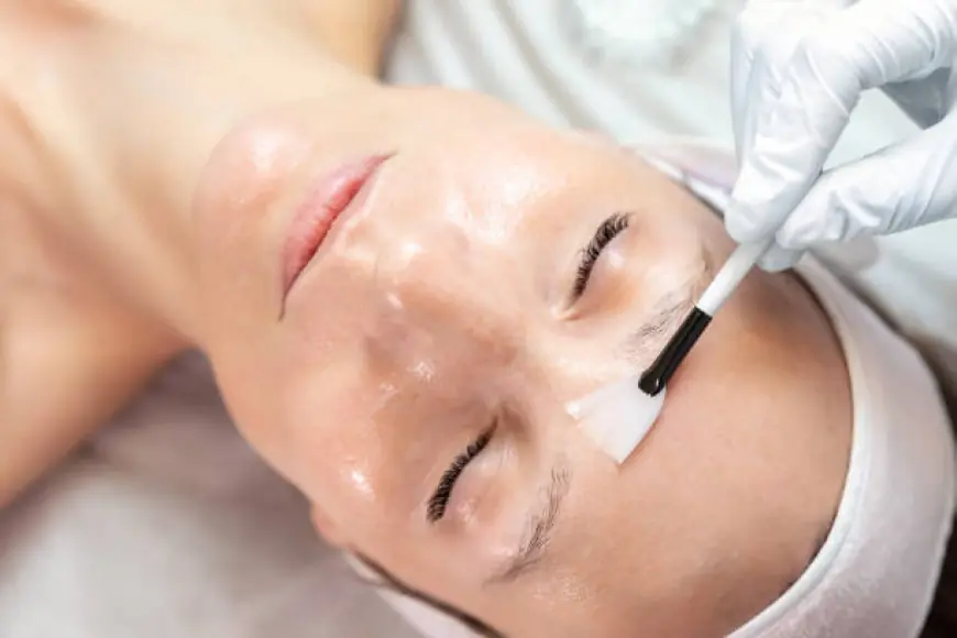 Are Chemical Peels Safe? What You Should Know Before Trying