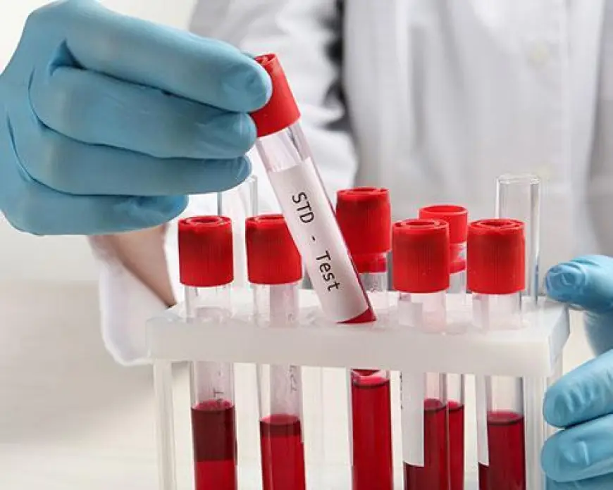 How to Choose the Best Clinic for STD Test in Dubai