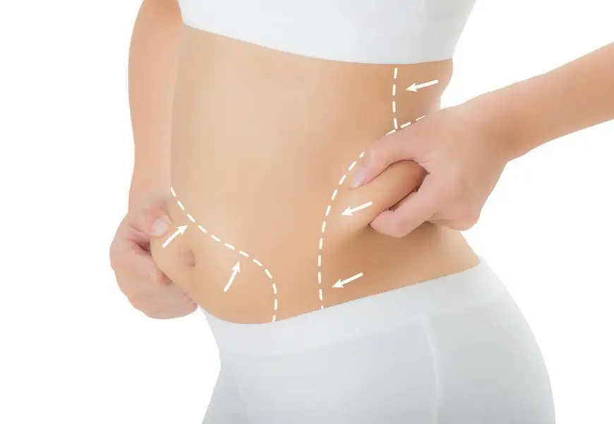 Cost Factors for Tummy Tuck Surgery in Dubai Explained