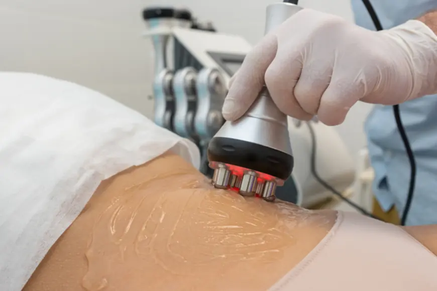 Is RF Treatment Effective for Loose Skin After Weight Loss?