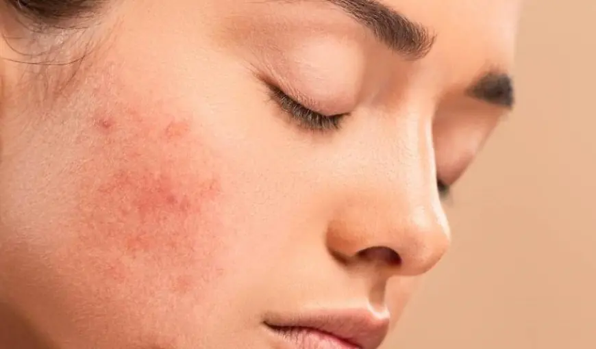 How long do the results of laser pigmentation treatment last?