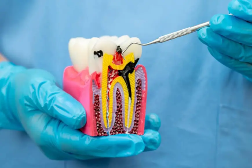 Can Root Canal Treatment Fail? Causes and Solutions