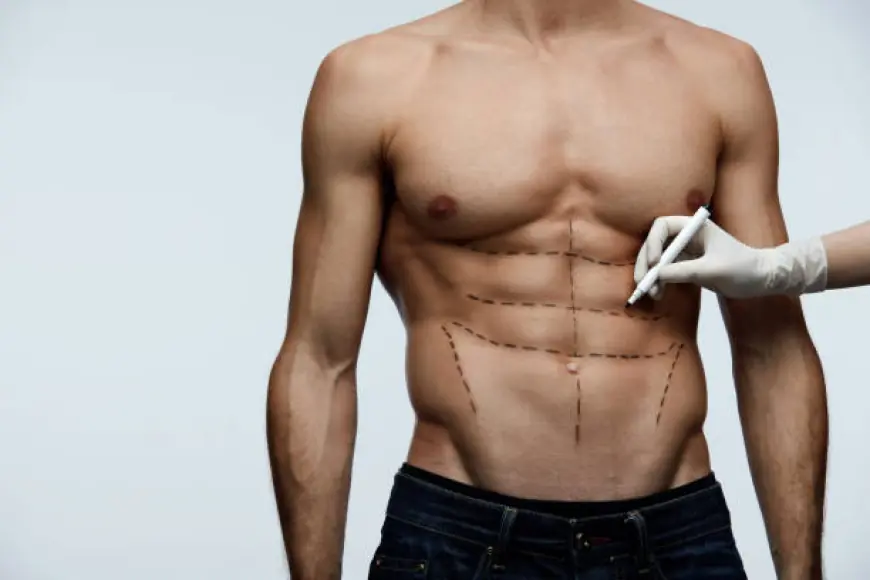 Liposuction Surgery in Dubai: Expert Advice on Post-Op Care