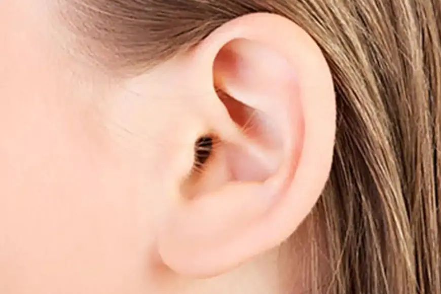 Ear Reshaping: Transform Your Ears and Facial Profile Quickly