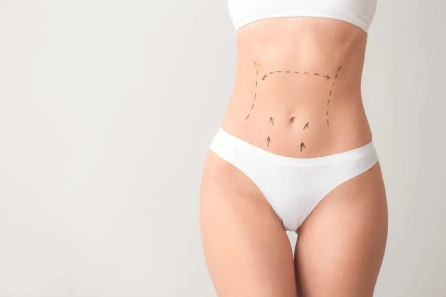 Tummy Tuck Surgery in Dubai for Men: What to Expect