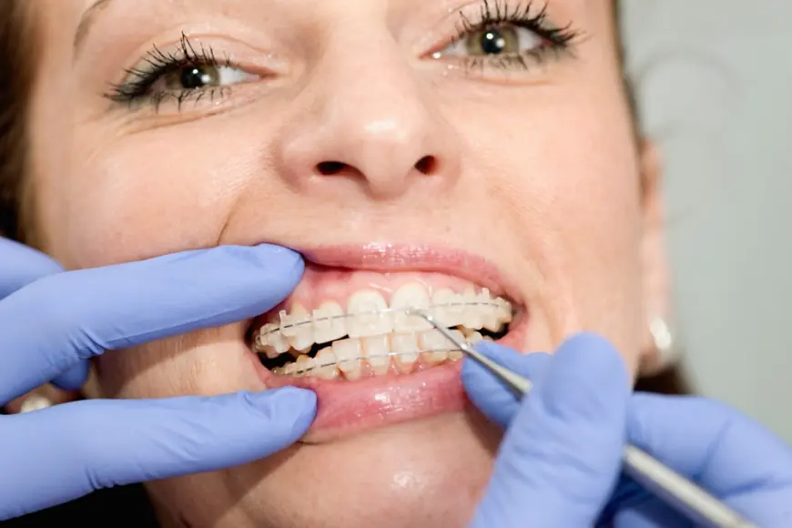 The Difference Between Pediatric Dentists and Orthodontists