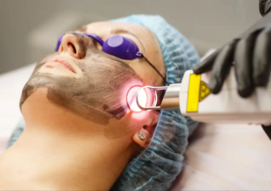 Who is the Ideal Candidate for PICO Laser in Islamabad?