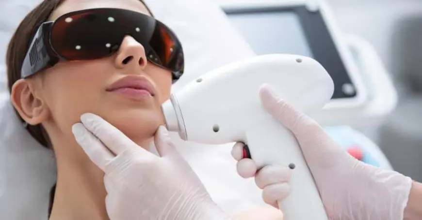 Can Laser Hair Removal Treat Hormonal Facial Hair?
