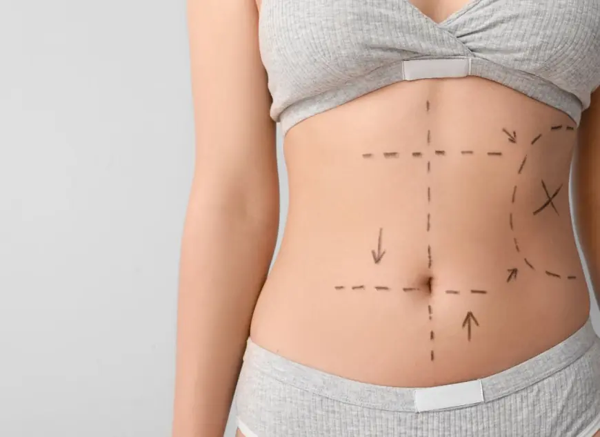 Does Best Liposuction Guarantee Flat Belly?