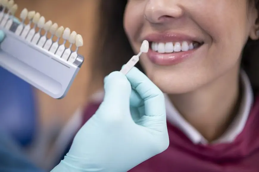 What to Expect During Your First Dental Veneer Consultation